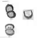 Fig. 02 - Collection and Storage Keepsake for Baby Teeth