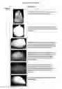 Fig. 01 - Pharmaceutical foam