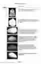 Fig. 03 - Pharmaceutical foam