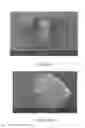Fig. 26 - Microfluidic devices, particularly filtration devices comprising polymeric membranes, and methods for their manufacture and use