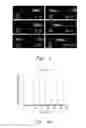 Fig. 04 - Microchip capillary electrophoresis absent electrokinetic injection