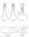 Fig. 02 - Within bottle aerator