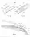 Fig. 03 - Within bottle aerator