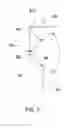 Fig. 08 - Vacuum resistant ribs for lightweight base technology containers