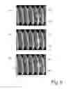 Fig. 10 - Particle beam microscope and method for operating the particle beam microscope