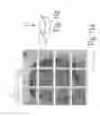 Fig. 12 - Particle beam microscope and method for operating the particle beam microscope