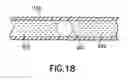 Fig. 25 - Device and method for determining activity of radiopharmaceutical material