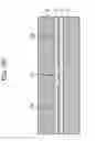 Fig. 22 - Laminate stacked capacitor, circuit substrate with laminate stacked capacitor and semiconductor apparatus with laminate stacked capacitor