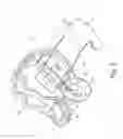 Fig. 03 - Fixing clamp and airbag unit
