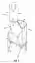 Fig. 03 - Disposable chair covers