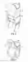 Fig. 04 - Disposable chair covers