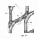 Fig. 03 - Encapsulated metal microtip microplasma devices, arrays and fabrication methods