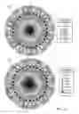 Fig. 17 - Methods and apparatuses for fault management in permanent magnet synchronous machines using the field reconstruction method
