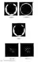 Fig. 09 - MRI coil design with volumetric trough-shaped coil elements