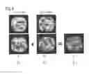 Fig. 04 - Magnetic resonance method and system to generate an optimized MR image of an examination subject