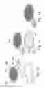 Fig. 12 - Resistance changing sensor