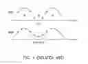 Fig. 02 - Data recovery device and method