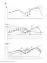 Fig. 03 - METHOD FOR RECONSTRUCTING A SPEECH SIGNAL AND HEARING DEVICE