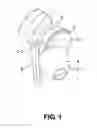 Fig. 02 - Earphone