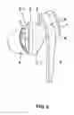 Fig. 03 - Earphone