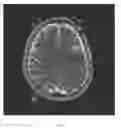 Fig. 07 - Method and system for obtaining brain characteristic parameters, thrombolysis decision guideline system and method thereof