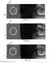 Fig. 18 - Methods and systems for noise reduction and image enhancement involving selection of noise-control parameter