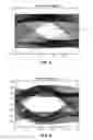 Fig. 04 - Jitter reduction of electrical signals from limiting optical modules