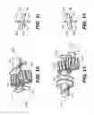 Fig. 13 - Methods for operating development station auger