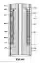 Fig. 08 - Wellbore fluid removal systems and methods