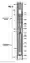 Fig. 09 - Wellbore fluid removal systems and methods