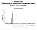 Fig. 14 - Lung cancer markers, and uses thereof