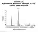 Fig. 15 - Lung cancer markers, and uses thereof