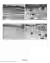 Fig. 03 - Method for the treatment of acquired lymphedema