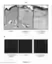 Fig. 26 - Method for the treatment of acquired lymphedema