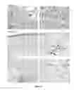 Fig. 29 - Method for the treatment of acquired lymphedema