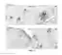 Fig. 33 - Method for the treatment of acquired lymphedema