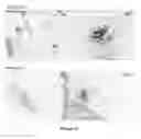 Fig. 34 - Method for the treatment of acquired lymphedema