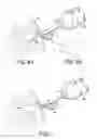Fig. 04 - POST-BIOPSY CAVITY TREATMENT IMPLANTS AND METHODS