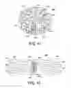 Fig. 20 - POST-BIOPSY CAVITY TREATMENT IMPLANTS AND METHODS