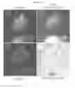 Fig. 20 - INDUCED PLURIPOTENT STEM CELL GENERATION USING TWO FACTORS AND P53 INACTIVATION
