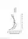 Fig. 05 - METHOD FOR TREATING INFLAMATION BY LYMPHOCYTE DEPLETION OR SEQUESTERING