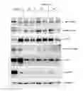 Fig. 15 - METHODS OF TREATING CANCERS WITH HER3 ANTISENSE OLIGONUCLEOTIDES