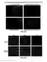 Fig. 16 - METHOD FOR INHIBITING NEURODEGENERATION