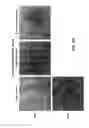 Fig. 22 - METHOD FOR INHIBITING NEURODEGENERATION