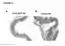 Fig. 41 - Antagonistic human LIGHT-specific human monoclonal antibodies