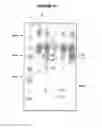 Fig. 15 - COMBINATIONS OF PNEUMOCOCCAL RRGB CLADES
