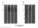 Fig. 13 - Surface-oriented antibody coating for the reduction of post-stent restenosis
