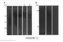 Fig. 15 - Surface-oriented antibody coating for the reduction of post-stent restenosis