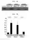 Fig. 08 - Polyion complex of double-stranded ribonucleic acid