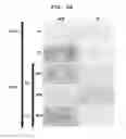 Fig. 10 - Polyion complex of double-stranded ribonucleic acid
